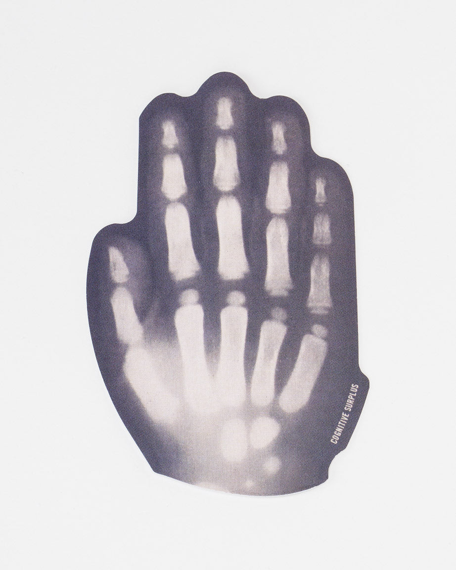 StXrayHand_02.jpg